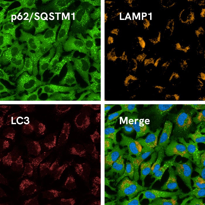 PhenoVue DNA Damage Response Staining Kit